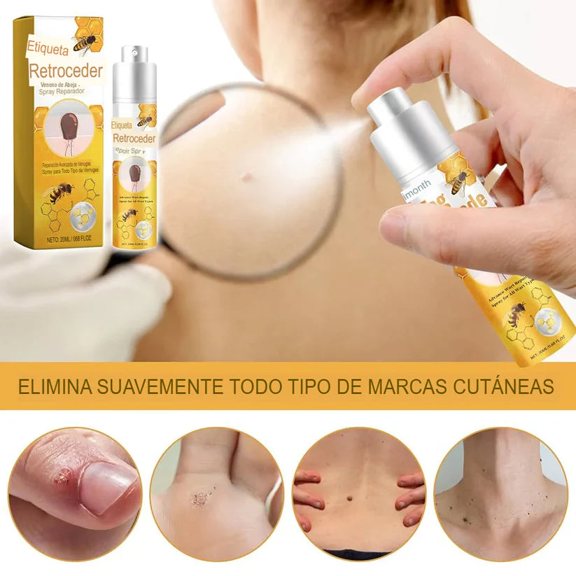 PROMO SOLO HOY 35% OFF Tag Recede Elimina verrugas y marcas sin dolor