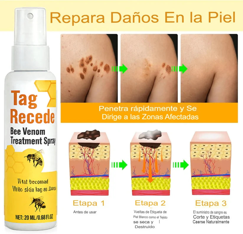 PROMO SOLO HOY 35% OFF Tag Recede Elimina verrugas y marcas sin dolor